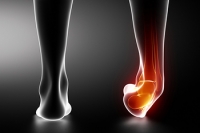 What to Know About Sprained Ankles