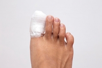 What to Do About a Broken Toe